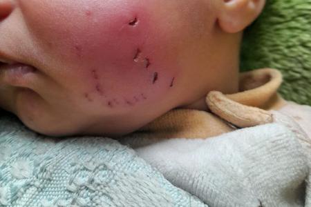 Nights of the tents... when rodents become a daily nightmare in Gaza