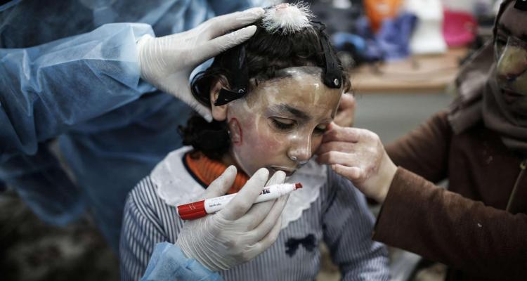 I no longer like looking in the mirror.. Injured people in Gaza are facing deformities
