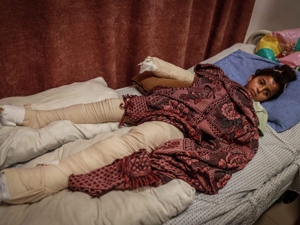 Children in Gaza bear lifelong trauma as a result of the ongoing attacks.